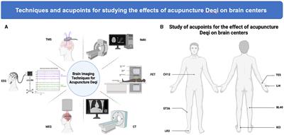Objectivization study of acupuncture Deqi and brain modulation mechanisms: a review